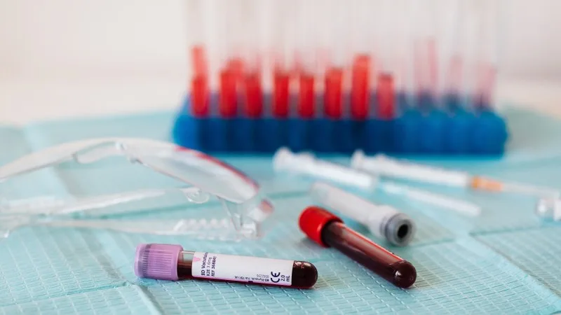 Laboratory blood samples for SARMs drug test, syringes, and goggles highlighting research preparation tools.
